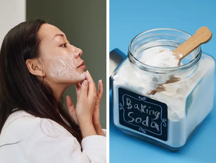 best home remedies for acne scars: Baking Soda